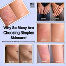 Before and after skincare results with text 'Why So Many Are Choosing Simpler Skincare!' on a blue background.